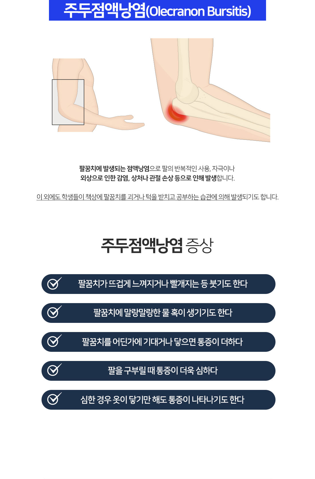 주두점액낭염-팔